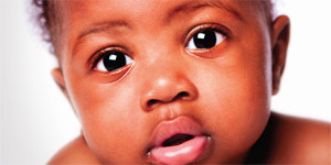 Why babies need eye check-ups - Parents Canada